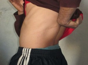 باع كليته بـ 1400 دينار وأصبح ضيفا دائما على وحدة غسيل الكلى