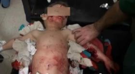 وفاة الطفل الذي نهشت الكلاب اعضاؤه التناسلية