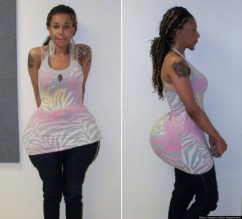 بالصور: جراح تجميل أميركي مزيف حقن مريضاته بالإسمنت والغراء