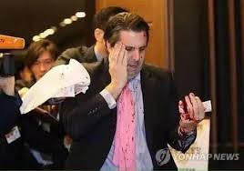 كوريا: ضرب سفير أمريكا بـ'شفرة حلاقة' في وجهه - صور وفيديو