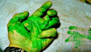 خبر صاعق .. الإنسان قد ينزف دمّاً أخضر اللّون في هذه الحالة!!