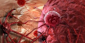 بالفيديو.. طبيب يفجر مفاجأة: عالجوا السرطان بالماء وهذا المكوّن!