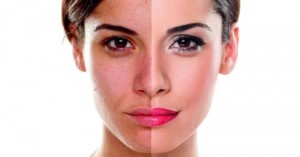 "بلازما" تجارية تخدع الباحثات عن نضارة البشرة