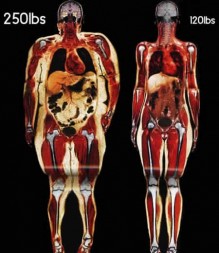 أنواع الدهون، وهل كل الدهون ضارة ؟