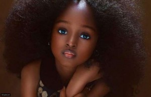 تعرفوا على أجمل طفلة في العالم التي أسرت القلوب بجمالها الاستثنائي