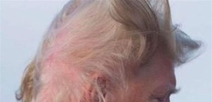 دواء يستخدمه ترامب للصلع .. قد ينقذ حياة الآلاف!