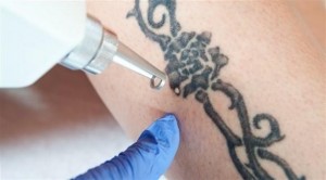 هل يرتبط وشم الجلد بمشاكل نفسية ؟