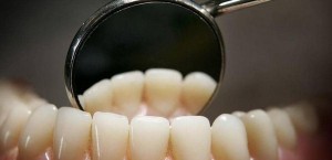 تغلب على أمراض اللثة بطرق منزلية!