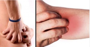 8 علامات تحذيرية لوجود خلل في وظائف الكلى