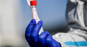 قائمة بالدول الأكثر تضررا من وباء كورونا