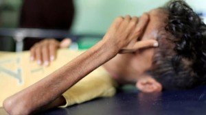 11 وفاة بسبب الجوع كل دقيقة بالعالم