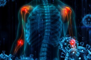 ارتفاع حالات آلام المفاصل والعظام بعد كورونا في الاردن