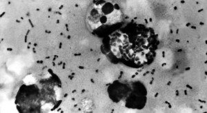 تسجيل إصابة بالطاعون الدبلي في الصين