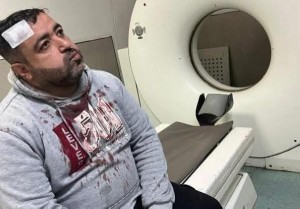 ضبط المعتدين على الزميل الصحفي فيصل التميمي